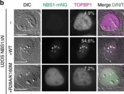 Knockdown Validated: Nbs1 Antibody [NB100-143]